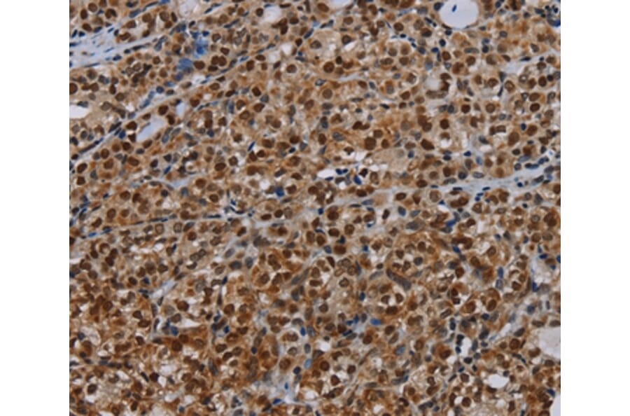 Immunohistochemistry - DCAF6 Antibody from Signalway Antibody (37778) - Antibodies.com