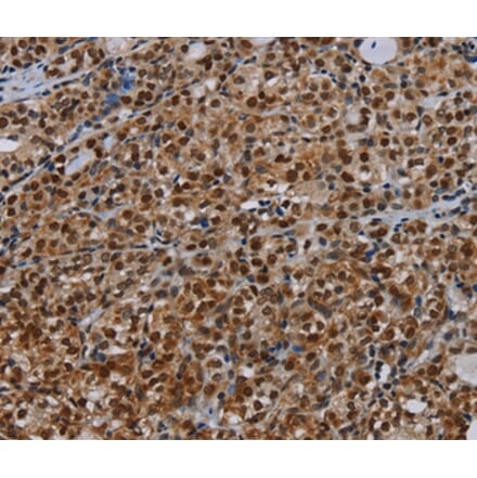 Immunohistochemistry - DCAF6 Antibody from Signalway Antibody (37778) - Antibodies.com