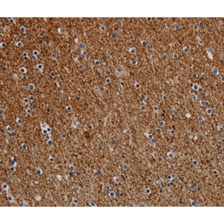 Immunohistochemistry - DCAF6 Antibody from Signalway Antibody (37778) - Antibodies.com
