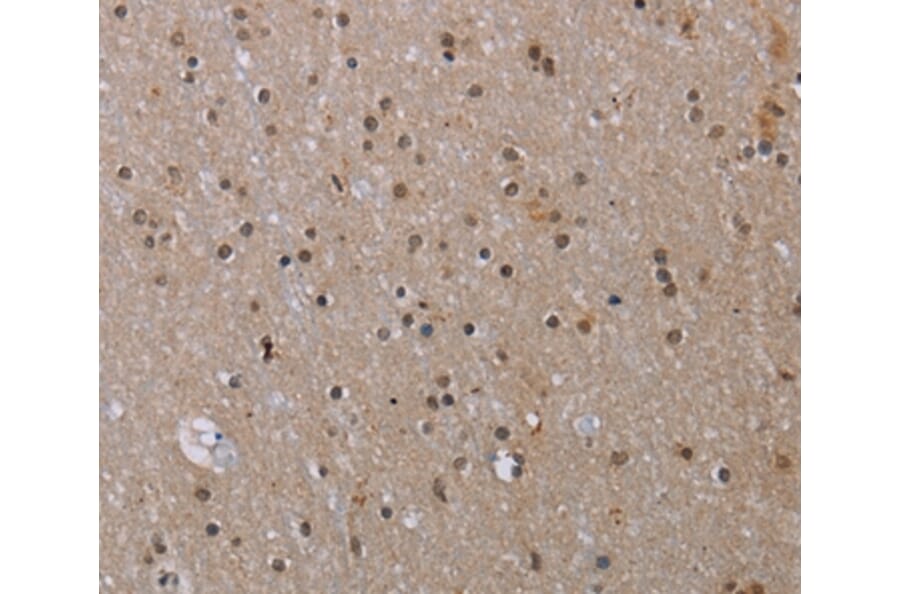 Immunohistochemistry - MED12 Antibody from Signalway Antibody (37786) - Antibodies.com