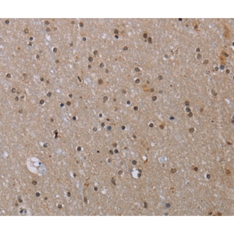 Immunohistochemistry - MED12 Antibody from Signalway Antibody (37786) - Antibodies.com