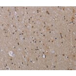 Immunohistochemistry - MED12 Antibody from Signalway Antibody (37786) - Antibodies.com