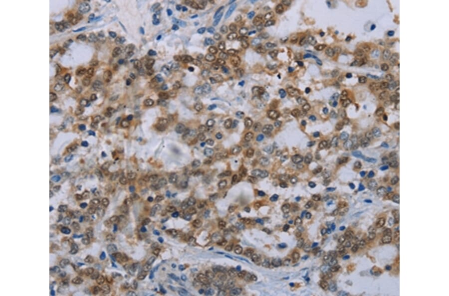 Immunohistochemistry - MED12 Antibody from Signalway Antibody (37786) - Antibodies.com