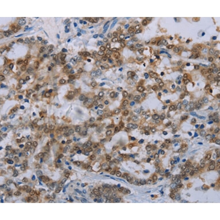 Immunohistochemistry - MED12 Antibody from Signalway Antibody (37786) - Antibodies.com