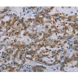 Immunohistochemistry - MED12 Antibody from Signalway Antibody (37786) - Antibodies.com