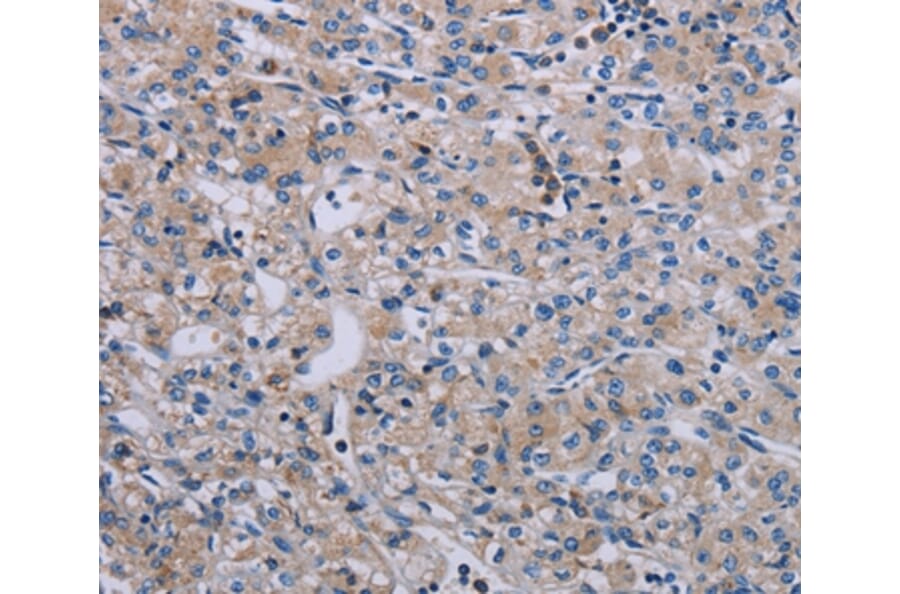Immunohistochemistry - PAGE4 Antibody from Signalway Antibody (37793) - Antibodies.com