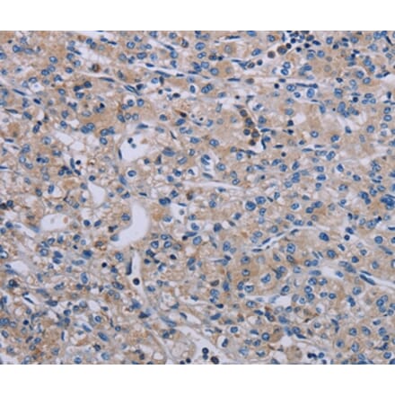 Immunohistochemistry - PAGE4 Antibody from Signalway Antibody (37793) - Antibodies.com