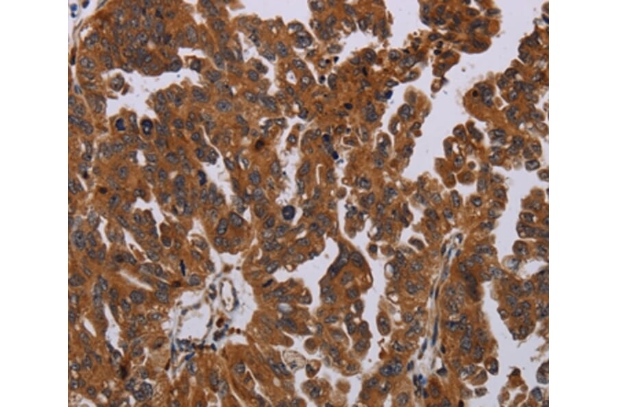 Immunohistochemistry - PAPPA Antibody from Signalway Antibody (37794) - Antibodies.com