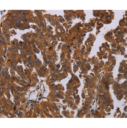 Immunohistochemistry - PAPPA Antibody from Signalway Antibody (37794) - Antibodies.com