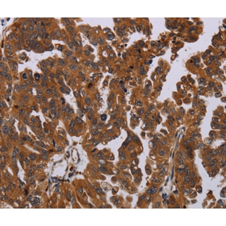 Immunohistochemistry - PAPPA Antibody from Signalway Antibody (37794) - Antibodies.com