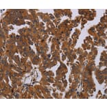 Immunohistochemistry - PAPPA Antibody from Signalway Antibody (37794) - Antibodies.com