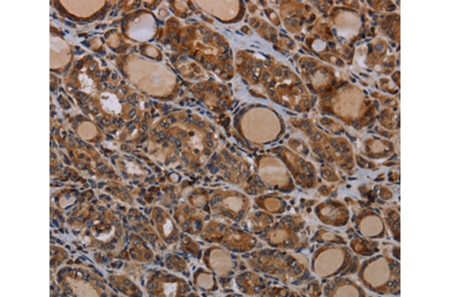 Immunohistochemistry - PAPPA Antibody from Signalway Antibody (37794) - Antibodies.com