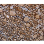 Immunohistochemistry - PAPPA Antibody from Signalway Antibody (37794) - Antibodies.com