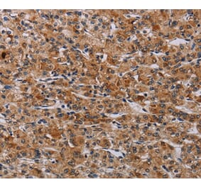 Immunohistochemistry - F2RL2 Antibody from Signalway Antibody (37795) - Antibodies.com