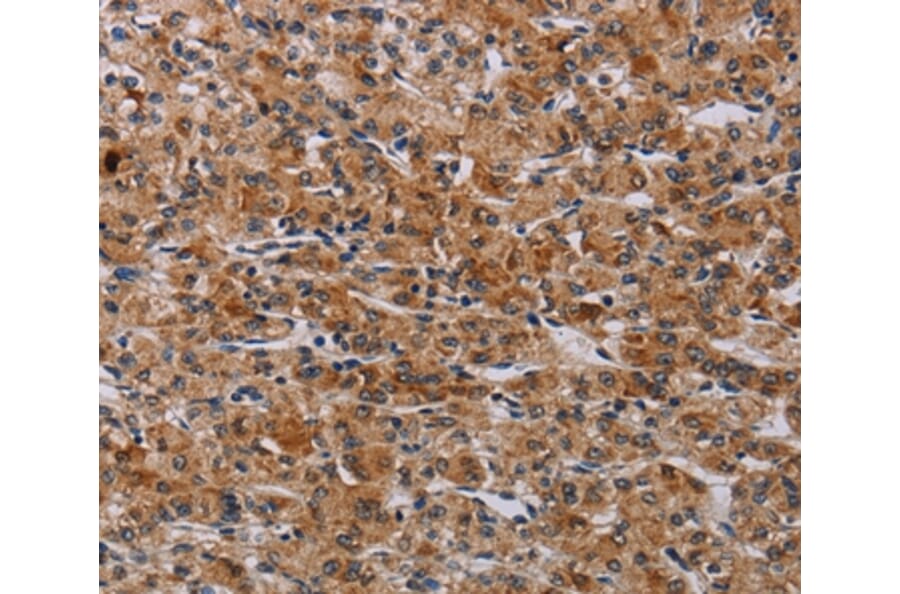Immunohistochemistry - F2RL2 Antibody from Signalway Antibody (37795) - Antibodies.com