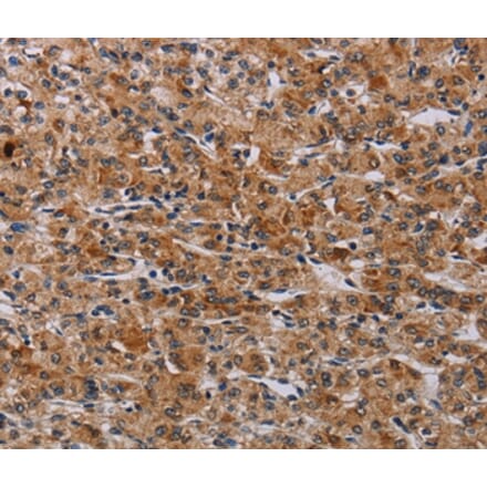 Immunohistochemistry - F2RL2 Antibody from Signalway Antibody (37795) - Antibodies.com