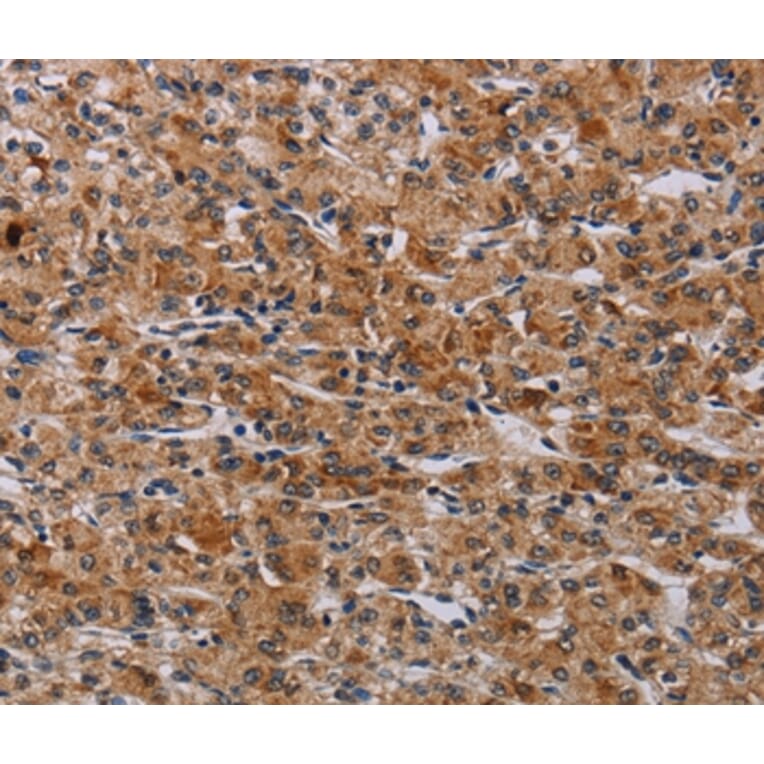 Immunohistochemistry - F2RL2 Antibody from Signalway Antibody (37795) - Antibodies.com