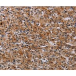 Immunohistochemistry - F2RL2 Antibody from Signalway Antibody (37795) - Antibodies.com