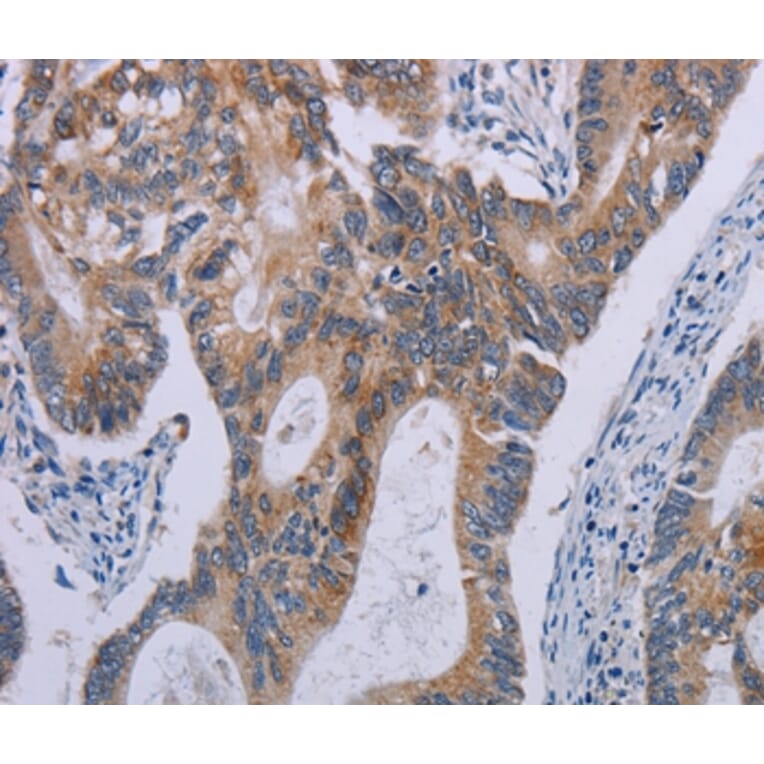 Immunohistochemistry - F2RL2 Antibody from Signalway Antibody (37795) - Antibodies.com