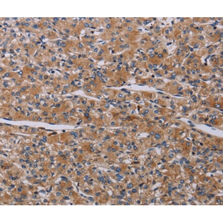 Immunohistochemistry - PARP4 Antibody from Signalway Antibody (37796) - Antibodies.com