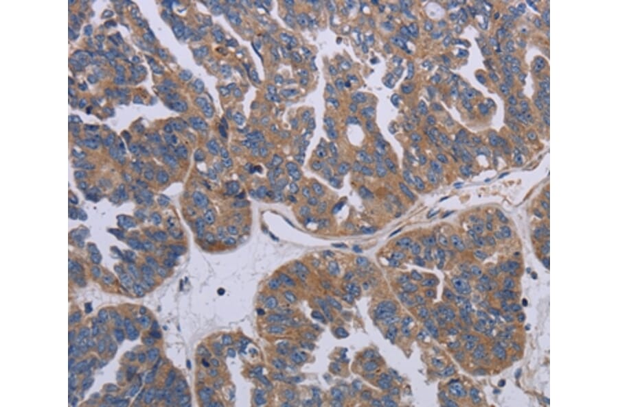 Immunohistochemistry - PARP4 Antibody from Signalway Antibody (37796) - Antibodies.com