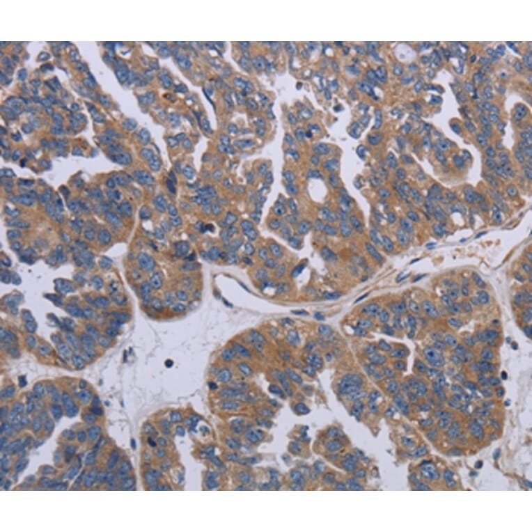 Immunohistochemistry - PARP4 Antibody from Signalway Antibody (37796) - Antibodies.com