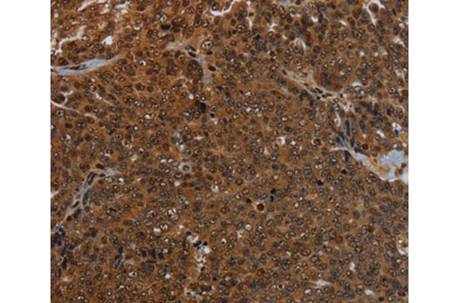 Immunohistochemistry - KDM4B Antibody from Signalway Antibody (37805) - Antibodies.com