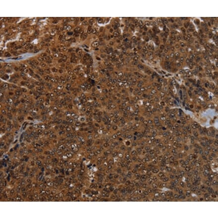 Immunohistochemistry - KDM4B Antibody from Signalway Antibody (37805) - Antibodies.com