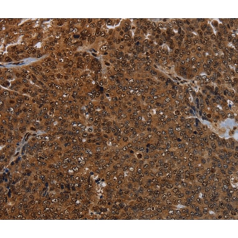 Immunohistochemistry - KDM4B Antibody from Signalway Antibody (37805) - Antibodies.com
