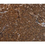 Immunohistochemistry - KDM4B Antibody from Signalway Antibody (37805) - Antibodies.com