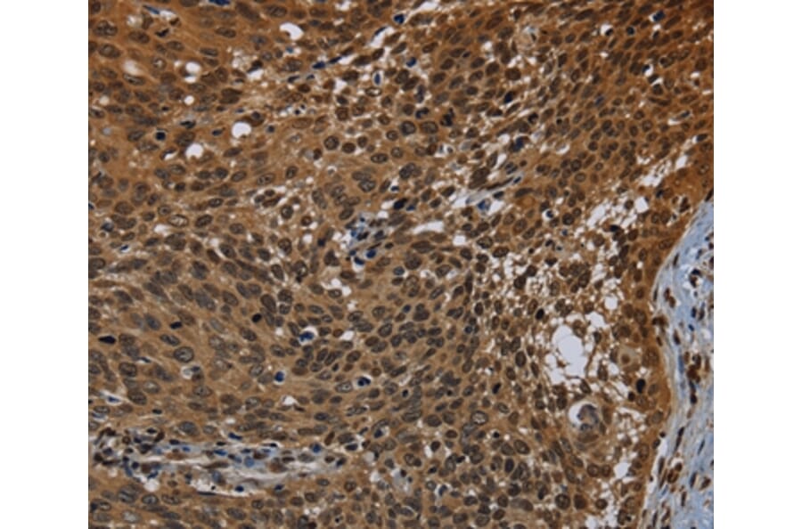 Immunohistochemistry - KDM4B Antibody from Signalway Antibody (37805) - Antibodies.com