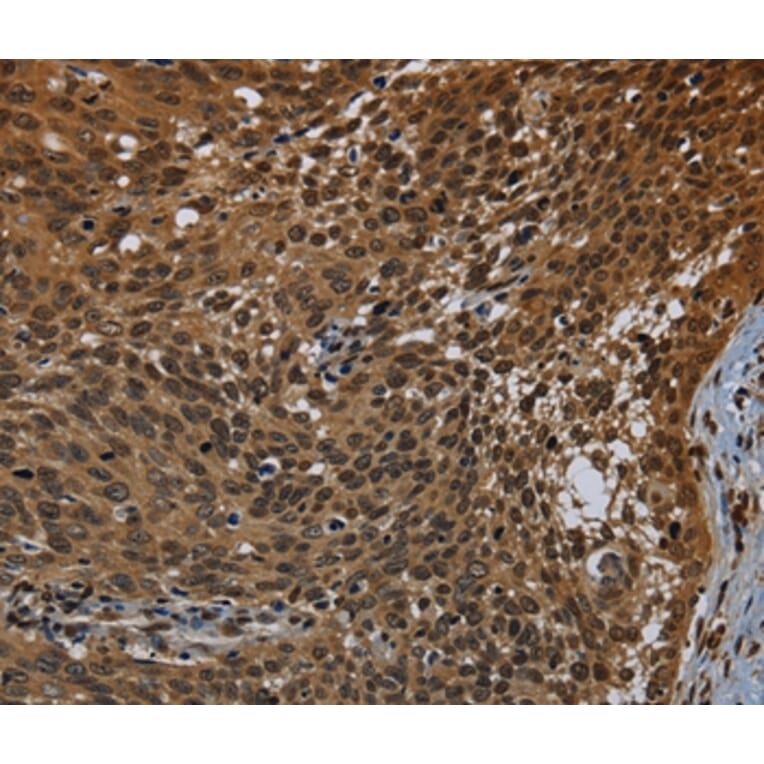 Immunohistochemistry - KDM4B Antibody from Signalway Antibody (37805) - Antibodies.com