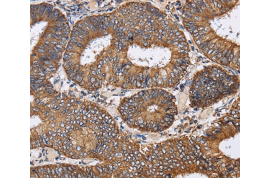 Immunohistochemistry - PDGFC Antibody from Signalway Antibody (37811) - Antibodies.com