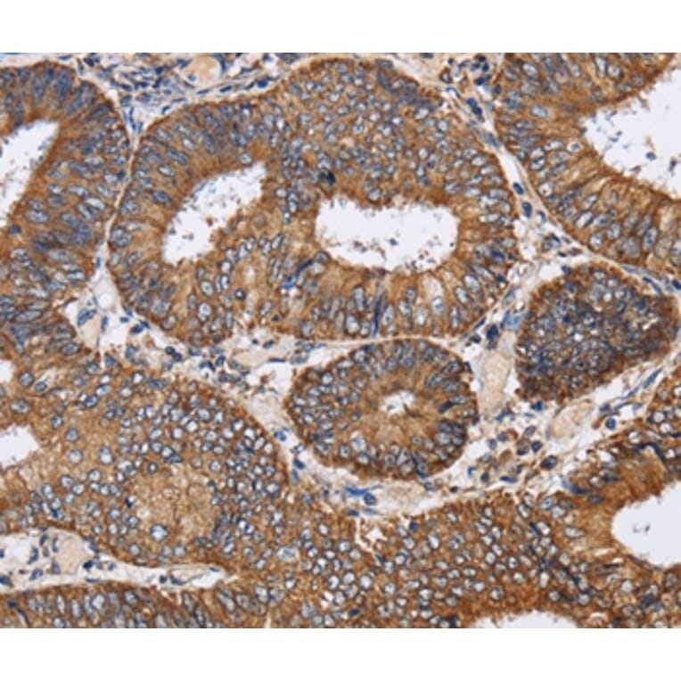 Immunohistochemistry - PDGFC Antibody from Signalway Antibody (37811) - Antibodies.com