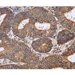 Immunohistochemistry - PDGFC Antibody from Signalway Antibody (37811) - Antibodies.com