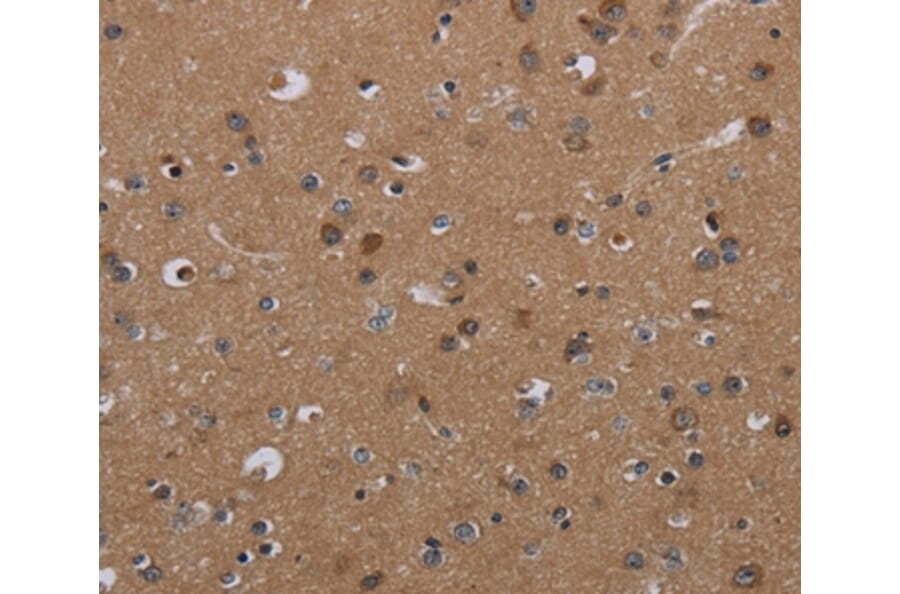 Immunohistochemistry - PDGFC Antibody from Signalway Antibody (37811) - Antibodies.com