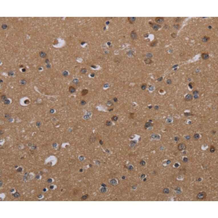 Immunohistochemistry - PDGFC Antibody from Signalway Antibody (37811) - Antibodies.com