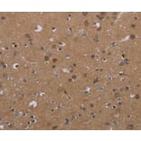 Immunohistochemistry - PDGFC Antibody from Signalway Antibody (37811) - Antibodies.com