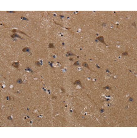 Immunohistochemistry - PLIN3 Antibody from Signalway Antibody (37816) - Antibodies.com