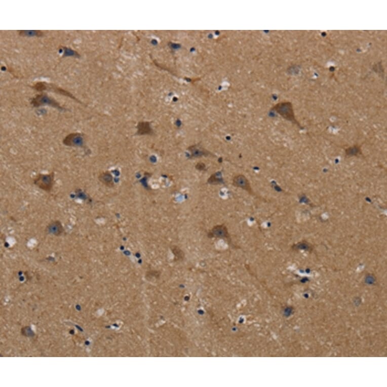 Immunohistochemistry - PLIN3 Antibody from Signalway Antibody (37816) - Antibodies.com