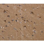 Immunohistochemistry - PLIN3 Antibody from Signalway Antibody (37816) - Antibodies.com