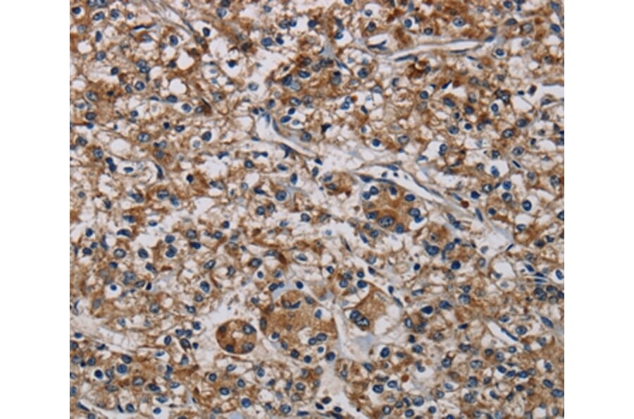 Immunohistochemistry - PLIN3 Antibody from Signalway Antibody (37816) - Antibodies.com