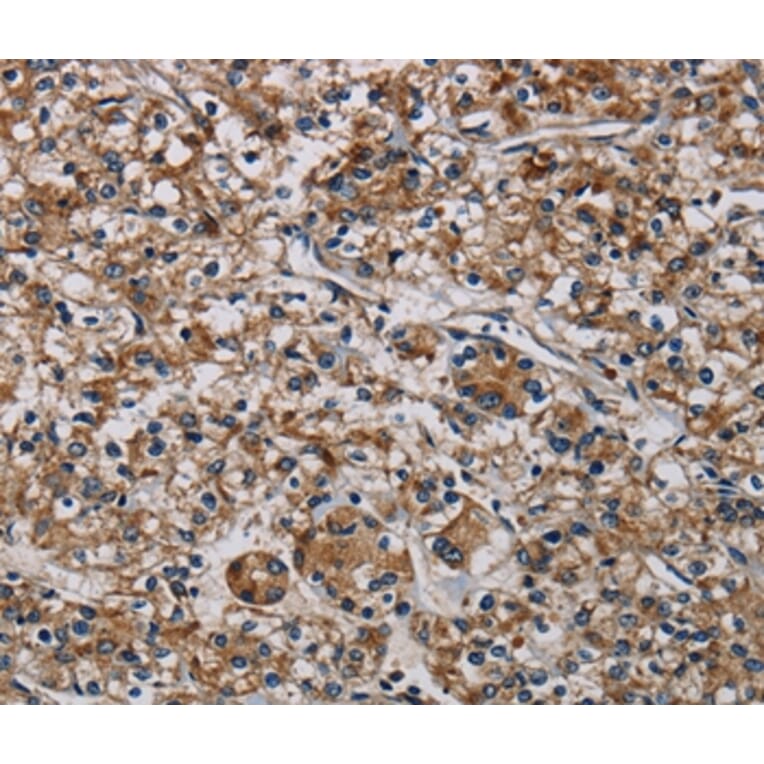 Immunohistochemistry - PLIN3 Antibody from Signalway Antibody (37816) - Antibodies.com