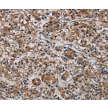 Immunohistochemistry - PLIN3 Antibody from Signalway Antibody (37816) - Antibodies.com