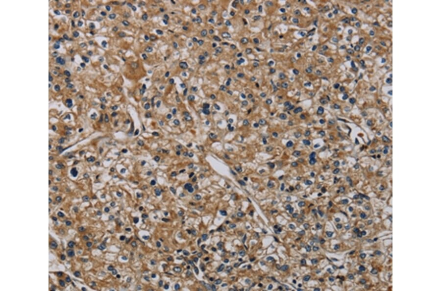 Immunohistochemistry - HSPG2 Antibody from Signalway Antibody (37817) - Antibodies.com
