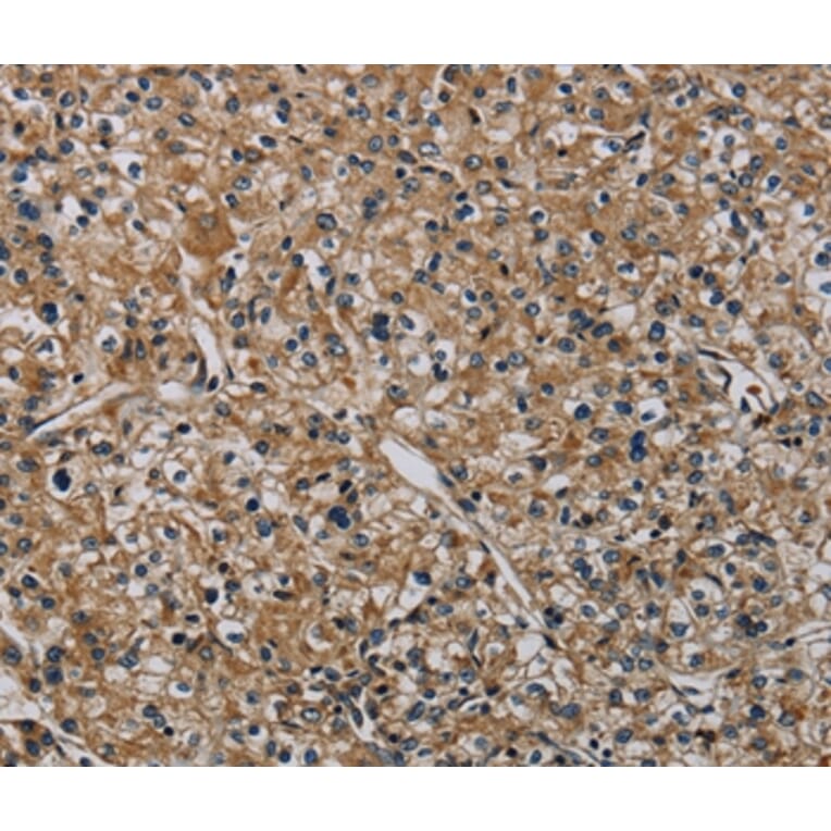 Immunohistochemistry - HSPG2 Antibody from Signalway Antibody (37817) - Antibodies.com