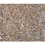 Immunohistochemistry - HSPG2 Antibody from Signalway Antibody (37817) - Antibodies.com