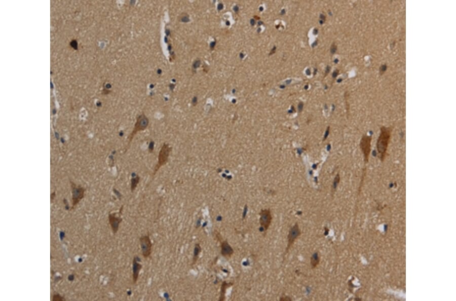 Immunohistochemistry - HSPG2 Antibody from Signalway Antibody (37817) - Antibodies.com