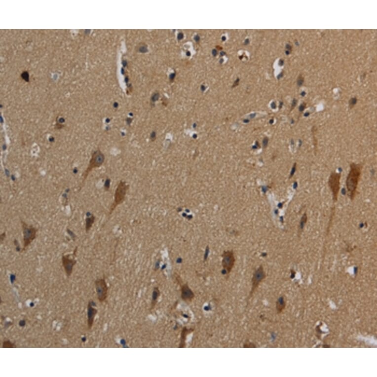 Immunohistochemistry - HSPG2 Antibody from Signalway Antibody (37817) - Antibodies.com