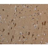 Immunohistochemistry - HSPG2 Antibody from Signalway Antibody (37817) - Antibodies.com